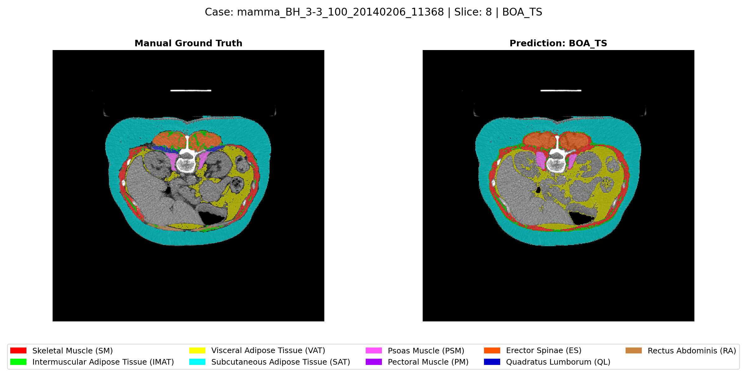Few- and Zero-Shot Learning for Automated Body Composition Analysis in CT Scans