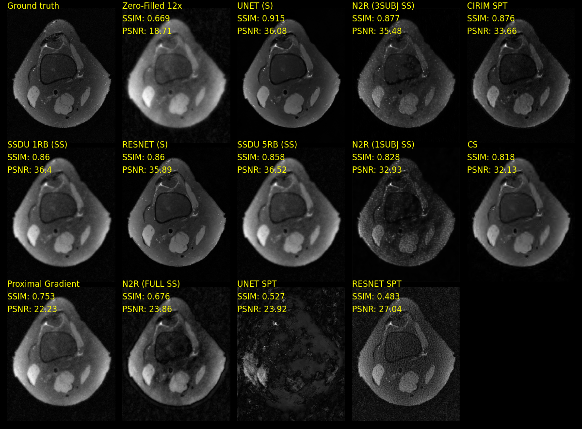 Evaluation of Supervision in Deep Learning Networks for Accelerated-MRI Reconstruction